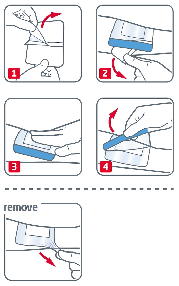 How to use Leukomed Sorbact by Leukoplast