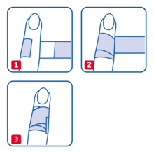 Instruction how to use Leukoplast Detectable finger dressing