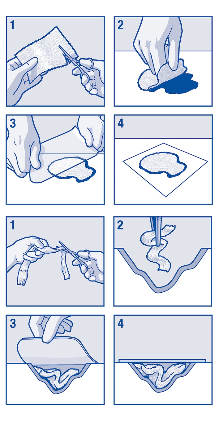 Image showing how to apply Cutimed® Alginate