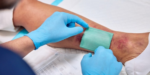 Infektionsmanagement mit Cutimed Sorbact
