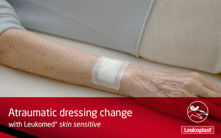 This video demonstrates how dressings can be removed from fragile skin without skin tears. An HCP is shown painlessly peeling a Leukomed skin sensitive dressing from an elderly woman's arm and applying a new Leukomed skin sensitive on the wound.