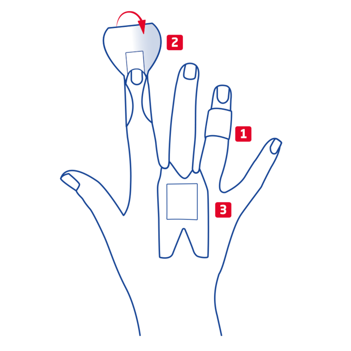 Overview of finger strip variants for knuckles, phalanx and fingertip