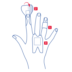 Übersicht der verschiedenen Optionen für Fingerknöchel, Fingerglieder und Fingerspitzen