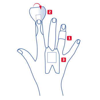 Overview of finger strip variants for knuckles, phalanx and fingertip