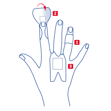 Overview of finger strip variants for knuckles, phalanx and fingertip Overview of finger strip variants for knuckles, phalanx and fingertip
