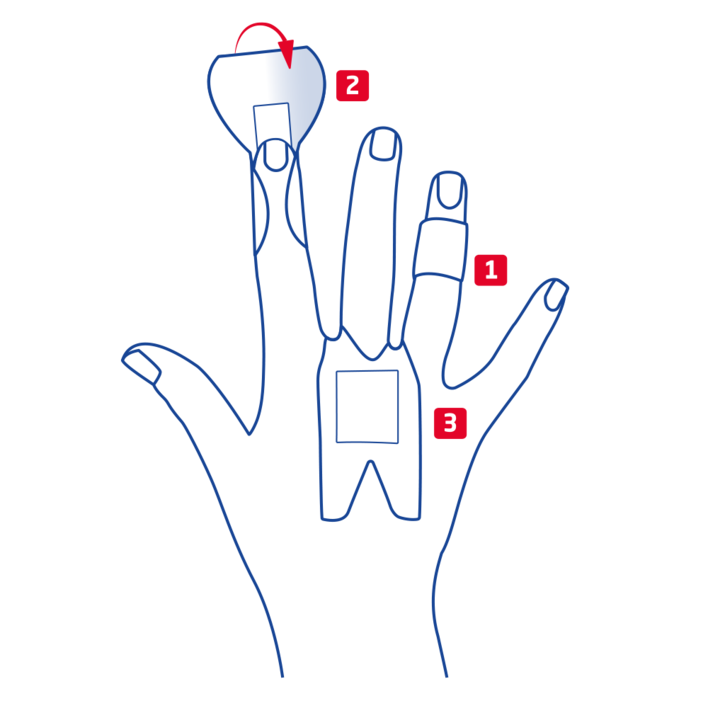 Overzicht vingerpleistervarianten voor knokkels, falanx en vingertop