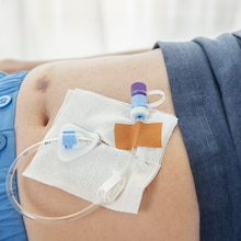 Fixação de cânulas com fita Leukoplast