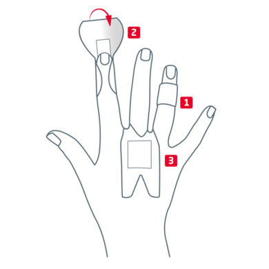 Overview of finger strip variants for knuckles, phalanx and fingertip Overview of finger strip variants for knuckles, phalanx and fingertip