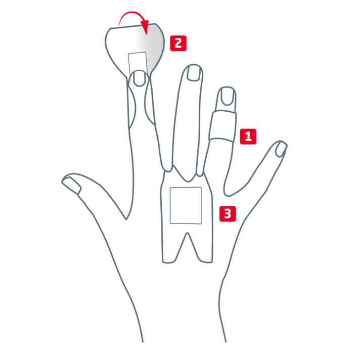 Overzicht vingerpleistervarianten voor knokkels, falanx en vingertop