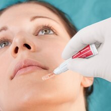 Leukosan Adhesive da Leukoplast, vista aproximada da aplicação no queixo