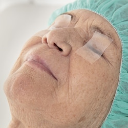 Silmäluomen kiinnitys Leukoplast skin sensitive -lääkinnällisellä teipillä