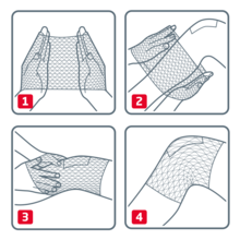 Modalità di utilizzo di Elastofix S
