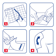 Anwendung von Fixomull stretch