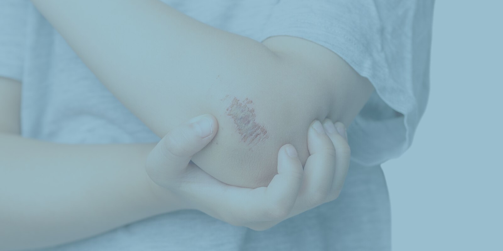 Pessoa com uma ferida no cotovelo, sob o título: «Feridas com crostas: sinal de boa cicatrização ou não?»