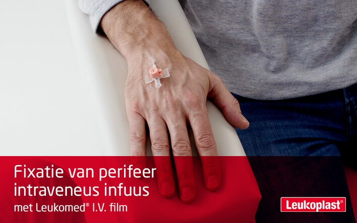 Deze film laat zien hoe een intraveneus infuus wordt gefixeerd met een infuuspleister: We zien hoe een zorgprofessional Leukoplast I.V. film aanbrengt op de rug van de hand van een patiënt en de venflon bevestigt.