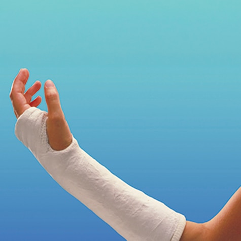Close-up of a person's arm wearing a cast tape 
