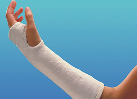 Close-up of a person's arm wearing a cast tape 