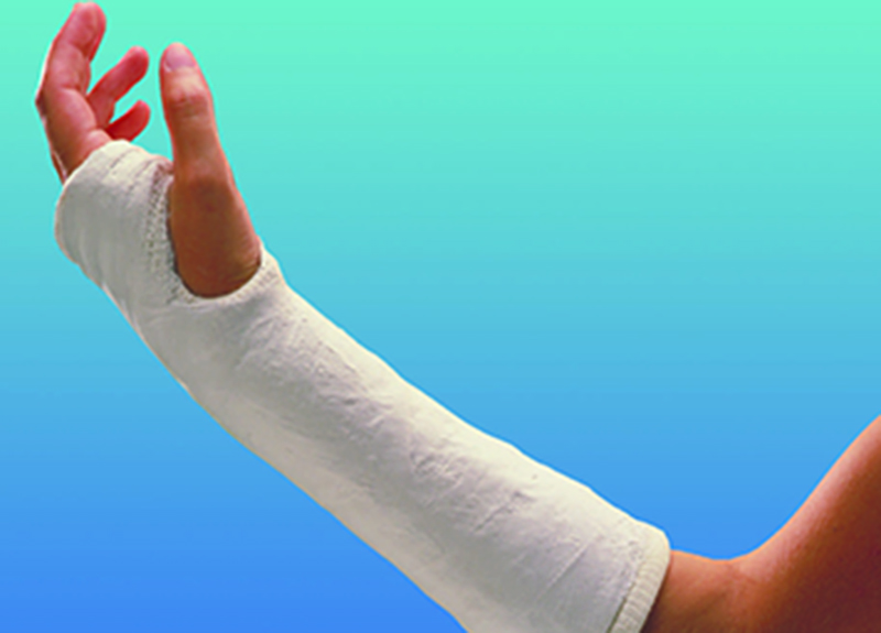 Close-up of a person's arm wearing a cast tape 