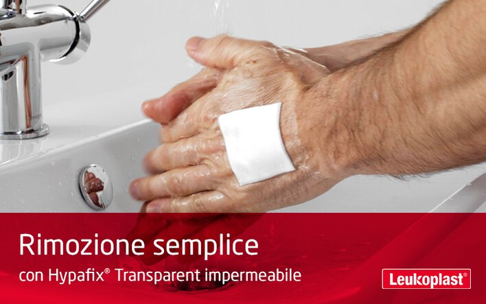 Questo video dimostra che Hypafix Transparent è una medicazione impermeabile per coprire le ferite: vediamo un paziente che lava le mani con una medicazione sul dorso della mano, che viene facilmente rimossa da un'operatore sanitario.