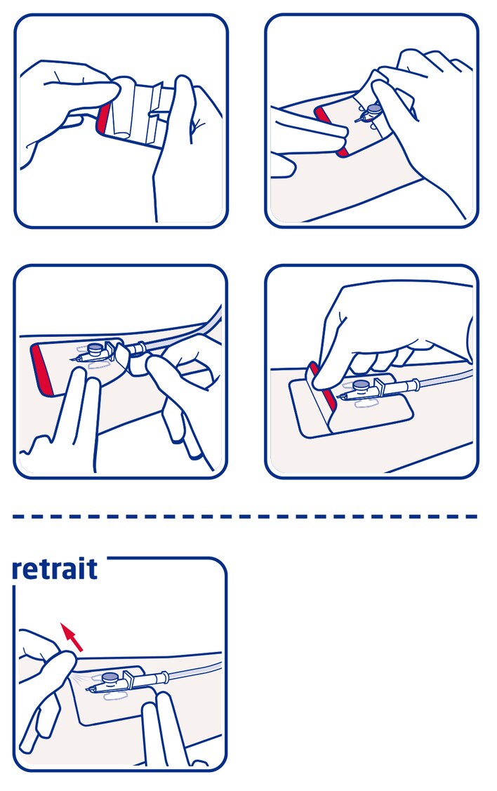 Indications d’utilisation - Leukomed IV film proposé par Leukoplast