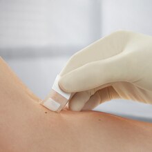Vista ravvicinata dell'applicazione del cerotto Leukoplast soft