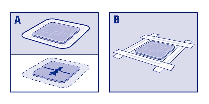 Dva obrázky znázorňující, jak aplikovat Cutimed Sorbion Carbon+/XL