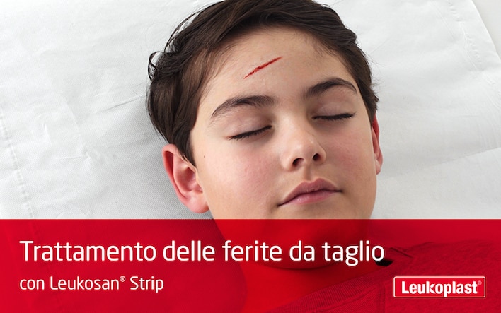 Questo video mostra come le ferite da taglio possono essere rimarginate utilizzando i cerotti per sutura: vediamo un operatore sanitario trattare un taglio sulla fronte di un ragazzo con l'aiuto di Leukosan Strip.