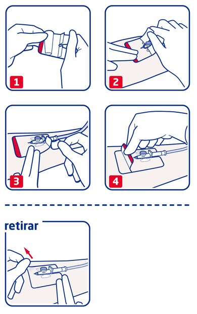 Cómo se usa Leukomed IV film Cómo se usa Leukomed IV film