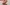 Mujer se rasca el brazo a causa de una reacción alérgica. Se lee el texto “Esparadrapo” en un recuadro