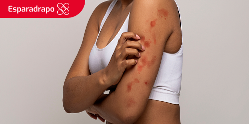 Mujer se rasca el brazo a causa de una reacción alérgica. Se lee el texto “Esparadrapo” en un recuadro