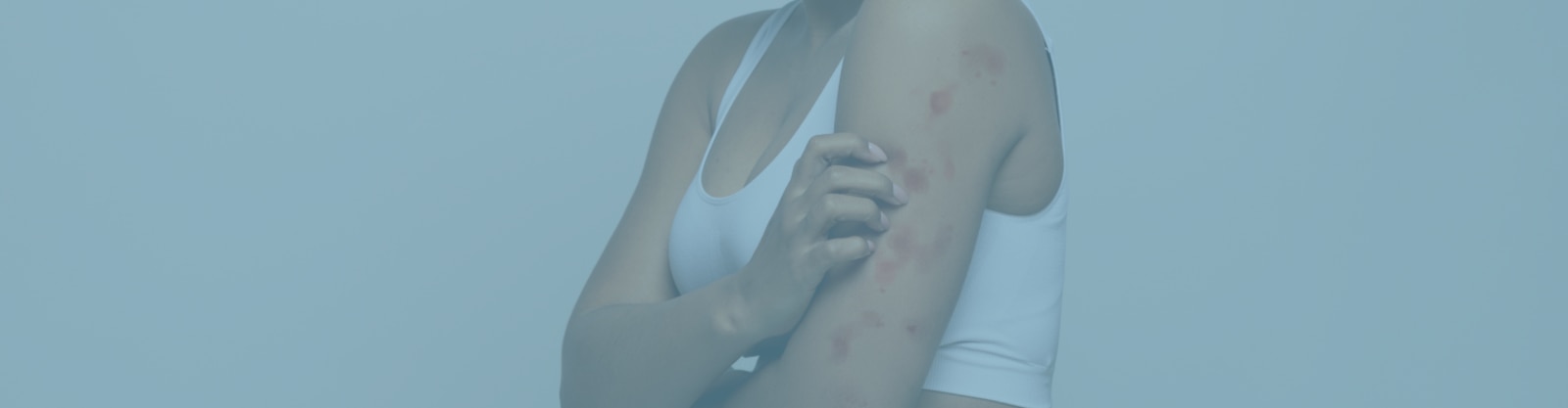 Donna si gratta il braccio a causa di una reazione allergica sotto il titolo “Dermatite o allergia cutanea? Scegli un cerotto ipoallergenico”.