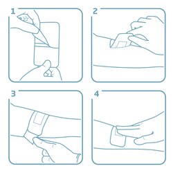 "Gebrauchsanweisung 1. Entfernen Sie die Klebeschutzfolie vom Verband. 2. Kleben Sie den Wundverband auf die Haut mit der Wundauflage direkt auf der Wunde.  3. Entfernen Sie die zweite Schutzfolie. 4. Drücken Sie sanft den Verband an und streichen Sie ihn aus. "