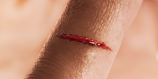 Close-up of a finger tip with a cut wound.