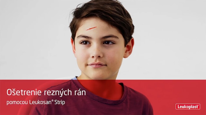 Tu je znázornené ošetrenie rezných rán pomocou prúžka Leukosan Strip: vidíme dve ruky zblízka, ktoré používajú prúžka na stiahnutie rany na čele chlapca.