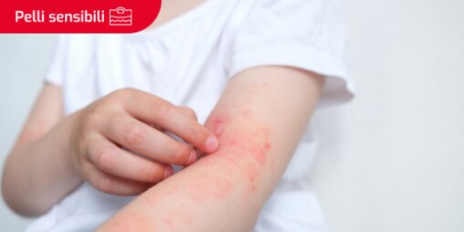 Bambino con prurito e irritazione del braccio a causa della pelle atopica. Il testo “Pelle sensibile” è scritto in un riquadro.