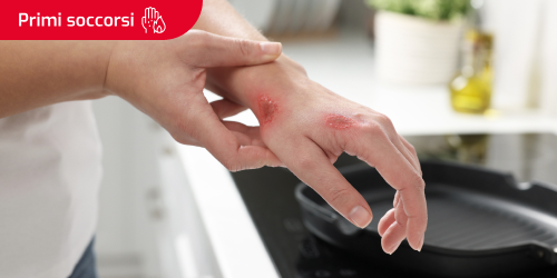 Persona in cucina con una bruciatura sulla mano e il testo “Primo soccorso” in un riquadro nell'angolo superiore sinistro.