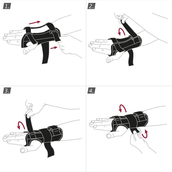 How to put on the Actimove Professional Line Manus Forte Wrist Brace: pull the brace over your wrist and close the straps
