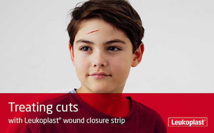 Hier wird gezeigt, wie Schnittwunden mithilfe von Leukoplast wound closure strip behandelt werden. Zu sehen ist eine Nahaufnahme von zwei Händen, die Wundnahtstreifen zum Verschliessen einer Schnittwunde an der Stirn eines Jungen aufbringen.