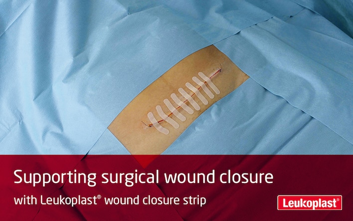 Hier zien we hoe Leukoplast wound closure strip kan worden gebruikt na een keizersnede: We zien de handen van een zorgprofessional een wondsluiting uitvoeren na een keizersnede.