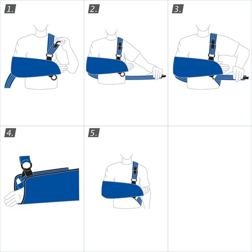 How to put on the Actimove Professional Line Umerus Comfort Shoulder Immobilizer: follow instructions on website or pack
