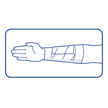 Bandage by Leukoplast usage instructions