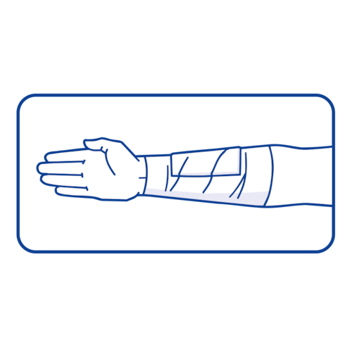 Elastiskt Bandage Till Hands Koncept För Hälso Och Sjukvård —  Stockfotografi © dexteris #506369316