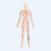 cutimed_website_wound-management_DiabeticFootUlcer_5_Systemic infection_280x280.jpg cutimed_website_wound-management_DiabeticFootUlcer_5_Systemic infection_280x280.jpg