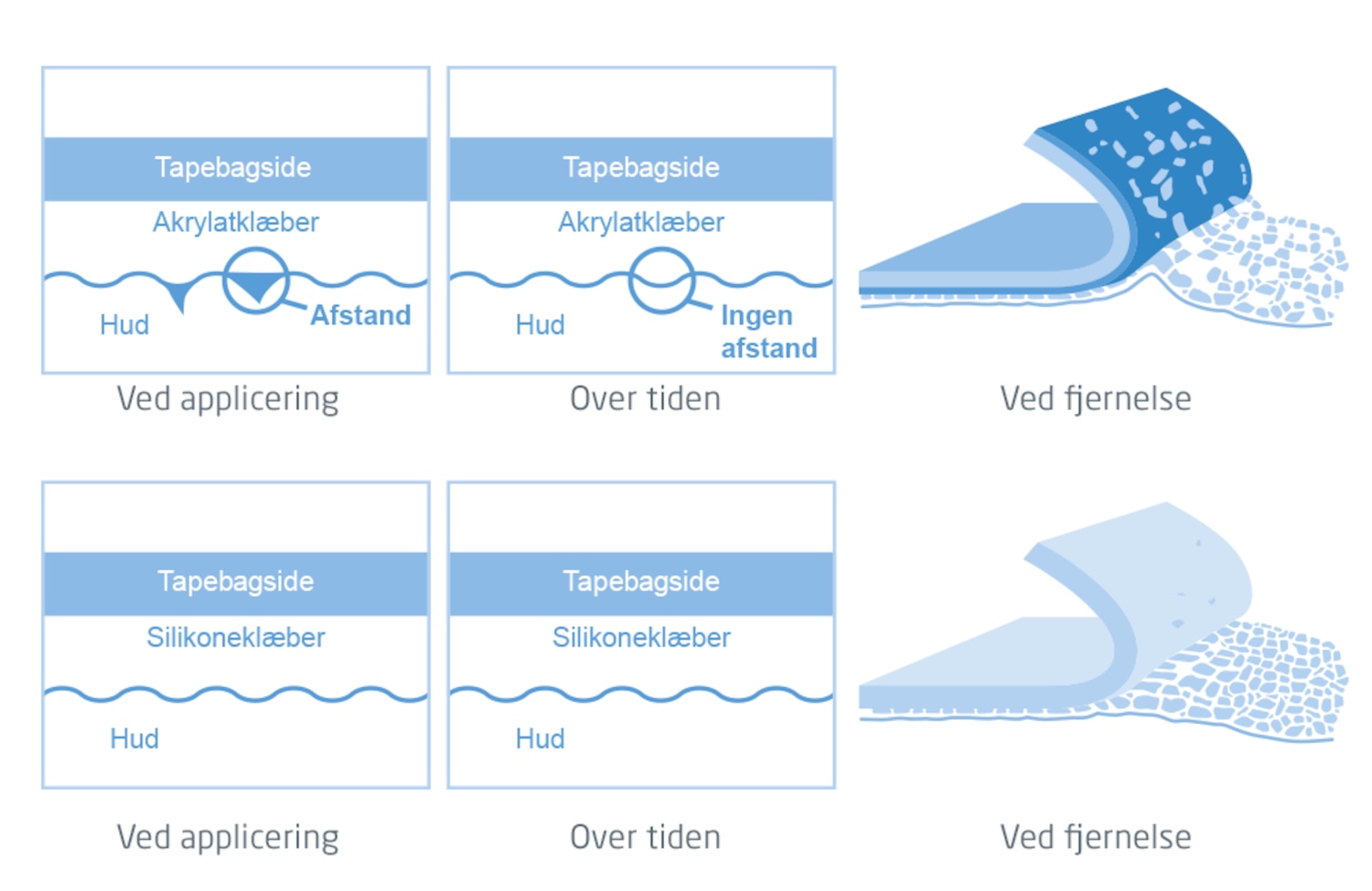 Illustration, der viser forskellene mellem standard- og silikoneklæbemidler ved påføring, over tid og ved fjernelse.