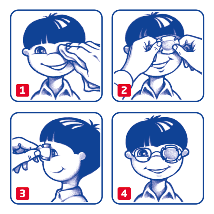 Eye occlusor by Leukoplast usage instructions
