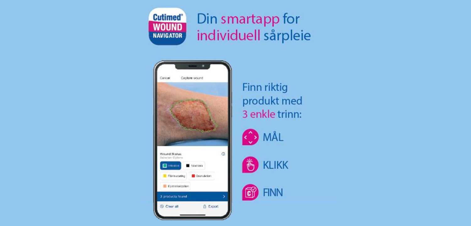 Din smartapp for individuell sårpleie - Cutimed Wound Navigator