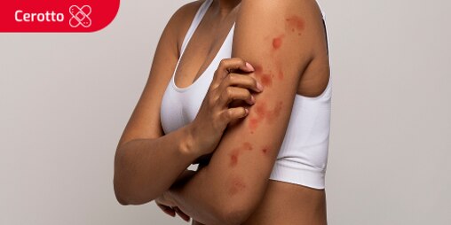 Una donna si gratta il braccio a causa di una reazione allergica. Il testo "Cerotto" è scritto in una casella.