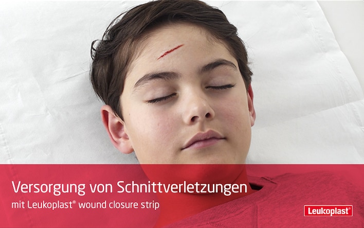 The video shows how cut wounds can be closed using wound closure strips: we see an HCP treating a cut on a boy's forehead with the help of Leukoplast wound closure strip.