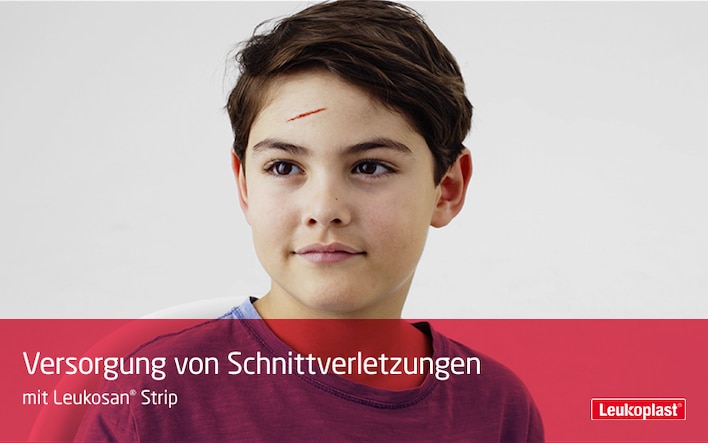 Hier zeigen wir Ihnen, wie Sie Schnittverletzungen mit der Hilfe von Leukosan® Strip verschließen können: Das Fachpersonal verschließt die Wunde auf der Stirn eines Jungen mit Leukosan® Strip.