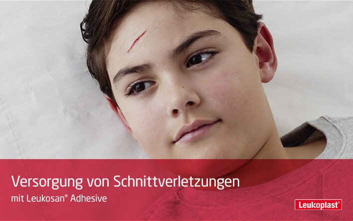 Das Video zeigt, wie Schnittverletzungen mit Leukosan® Adhesive geschlossen werden können: Das Fachpersonal verschließt die Wunde auf der Stirn eines Jungen ohne sie nähen zu müssen.